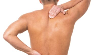 Unusual Presentations of Radiculopathy